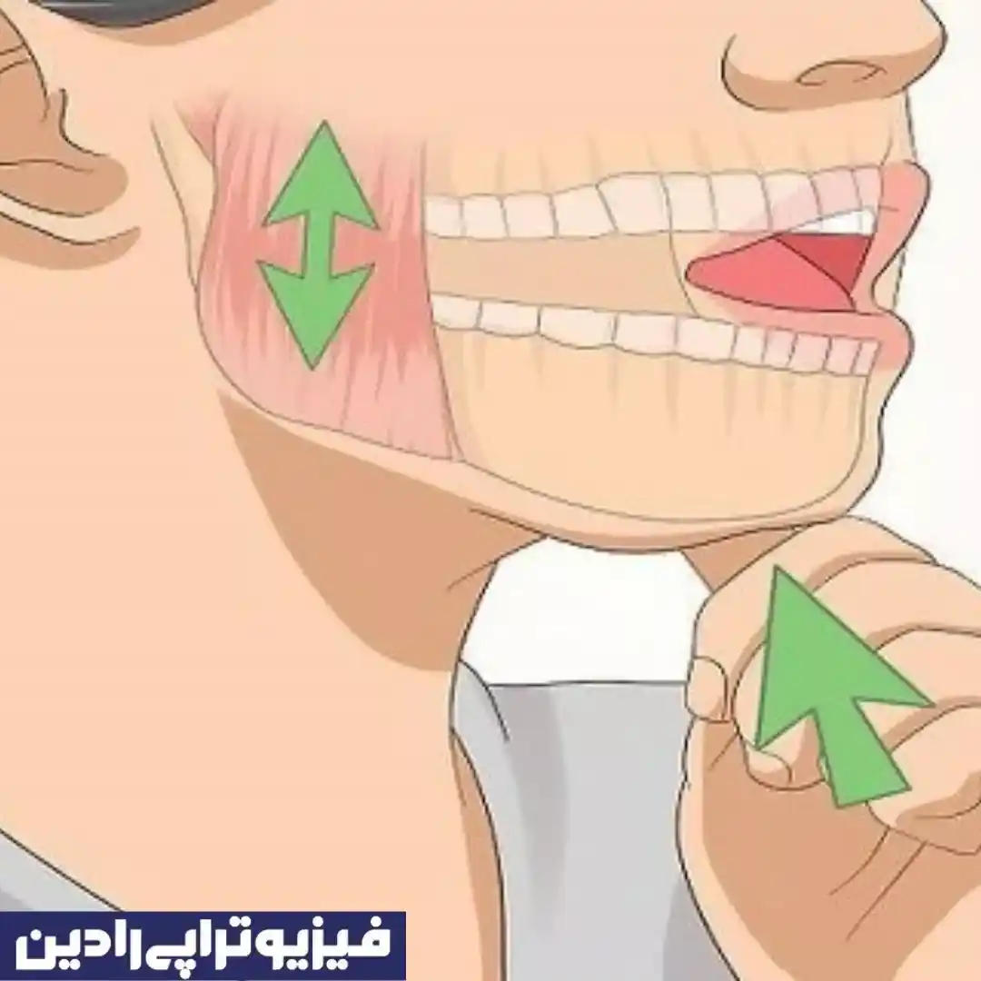 فیزیوتراپی فک