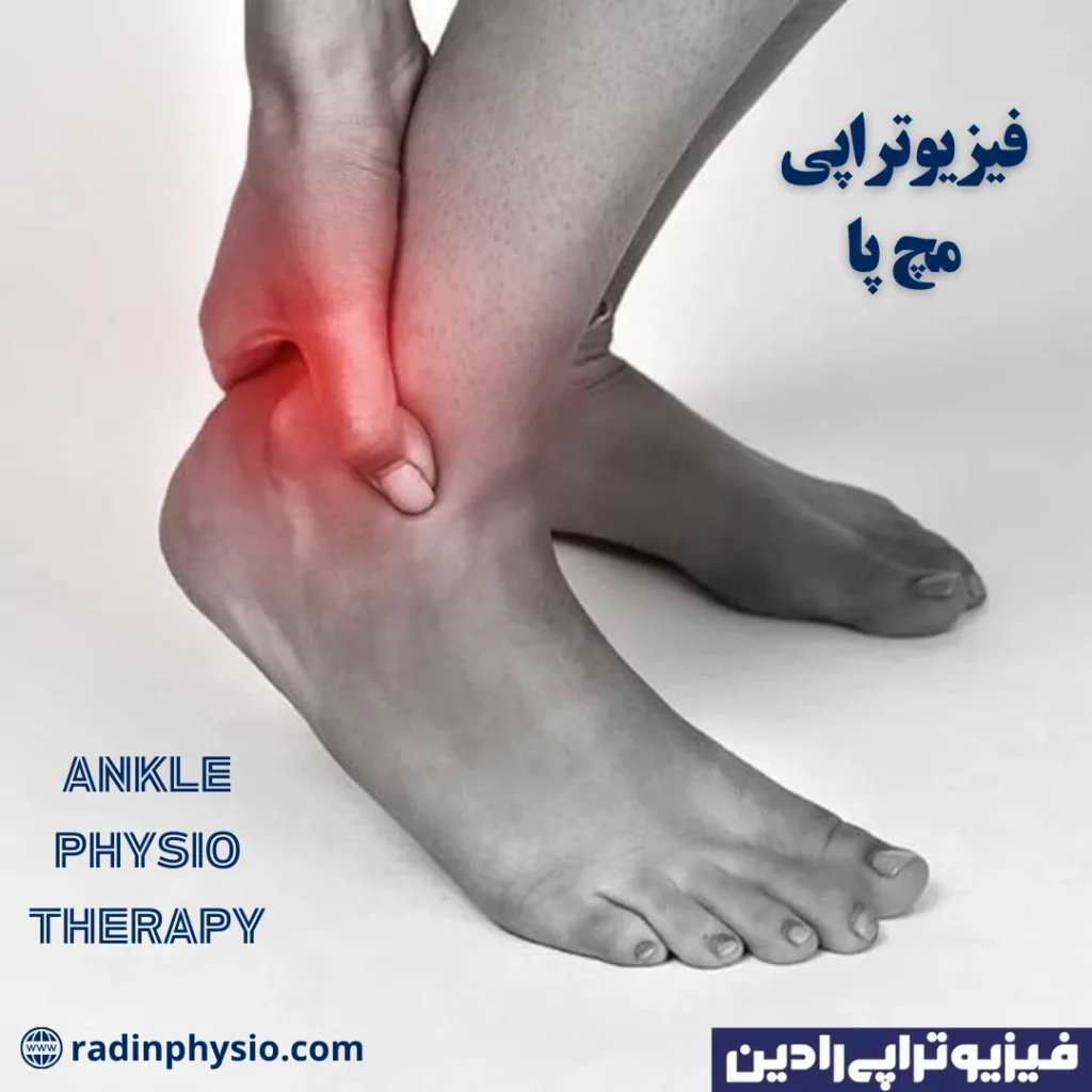 فیزیوتراپی مچ پا، 7 روش درمان - کلینیک فیزیوتراپی رادین