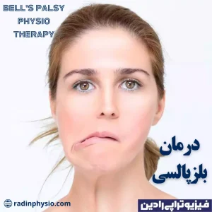 درمان بلزپالسی، فیزیوتراپی، فلج عصب صورت