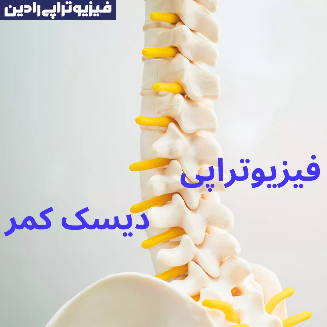 فیزیوتراپی دیسک کمر