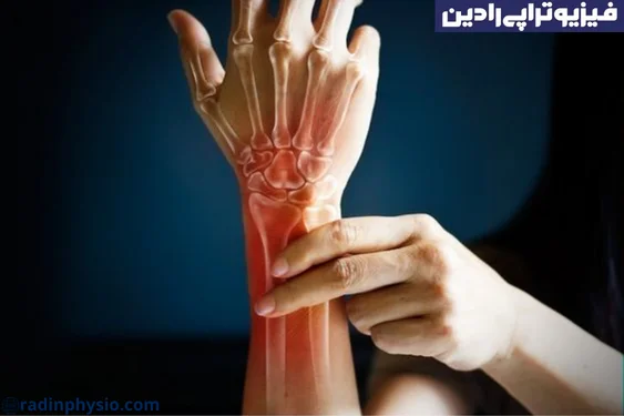 فیزیوتراپی آرتروز(Osteoarthritis) دست