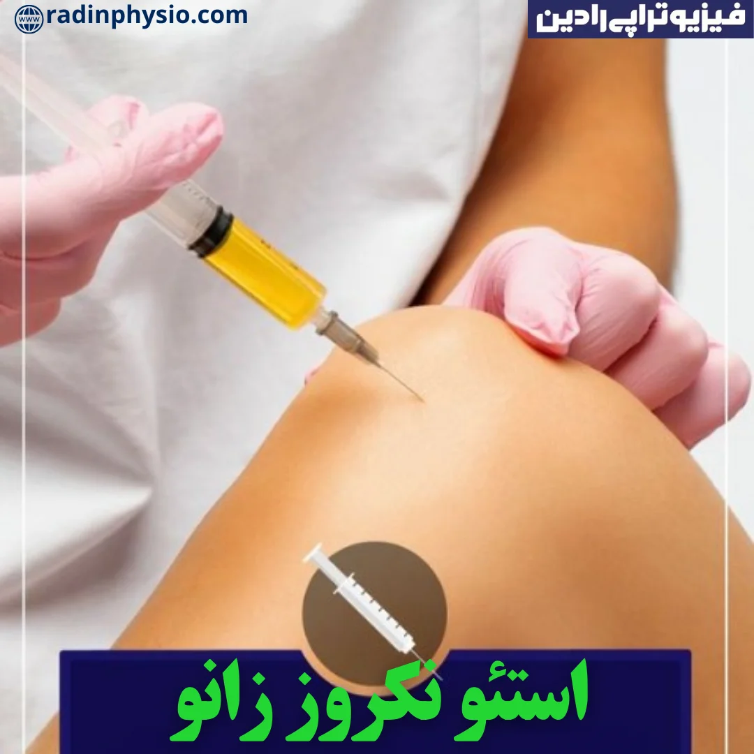 فیزیوتراپی استئونکروز زانو