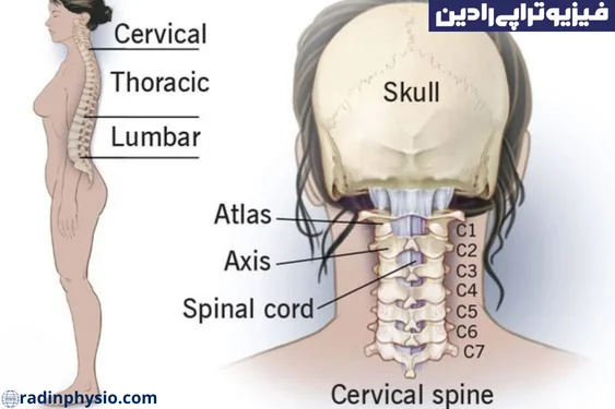 تنگی کانال نخاعی گردنی(Cervical spinal stenosis)