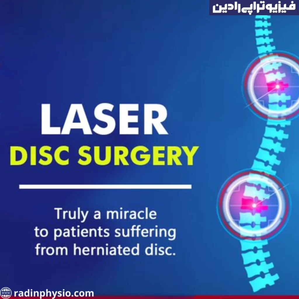 درمان دیسک کمر با لیزر
