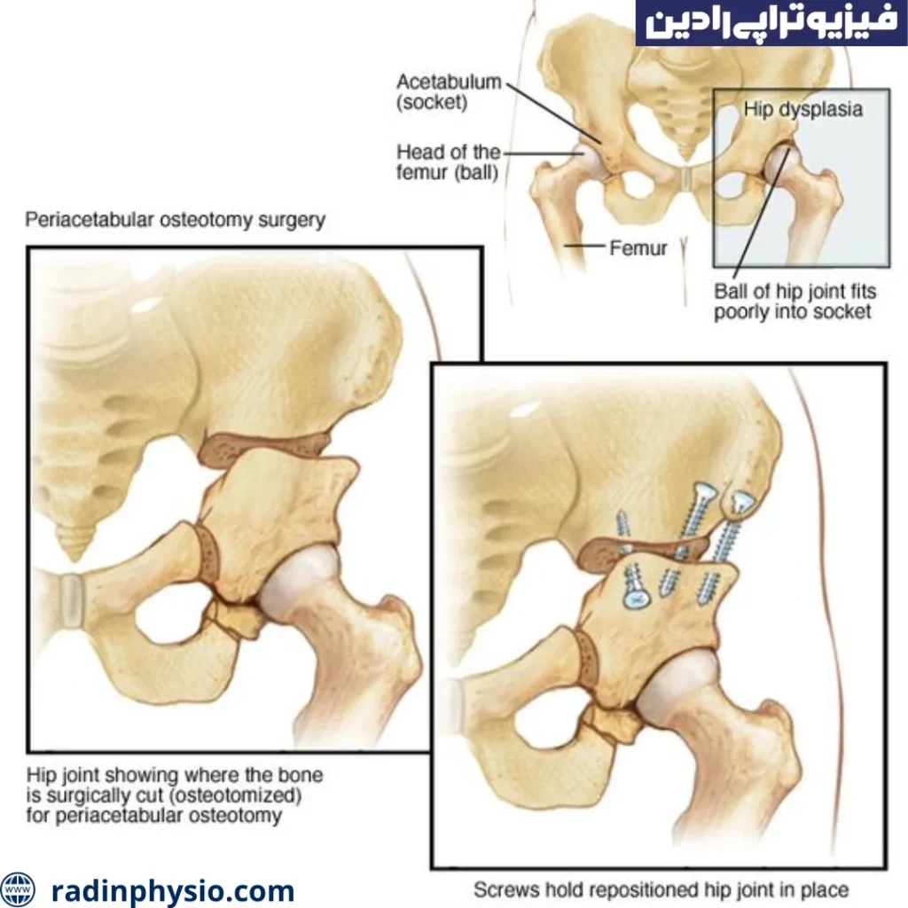 موارد منع استفاده از استئوتومی