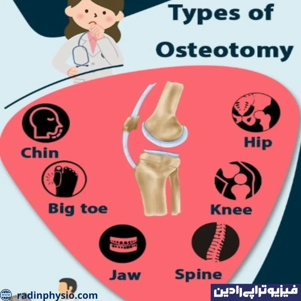 عمل استئوتومی زانو