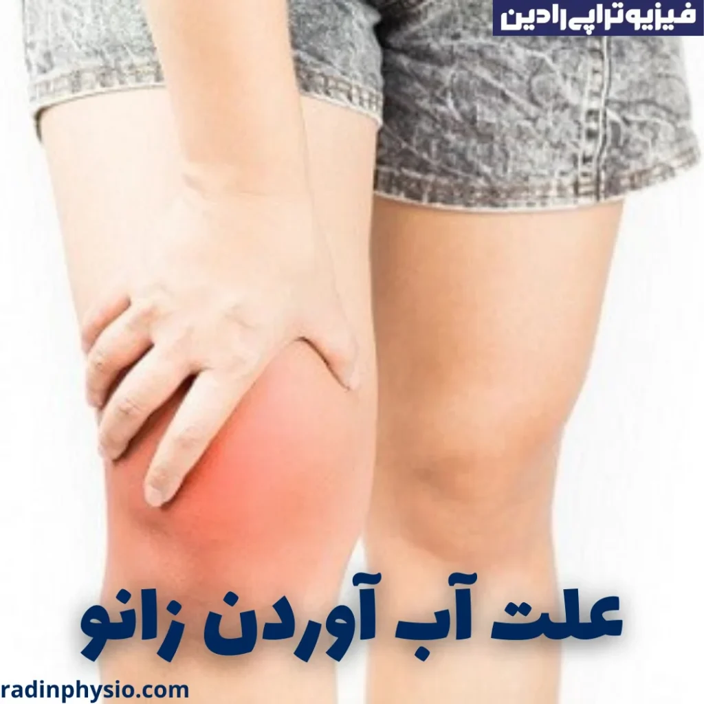 زانو آب آورده