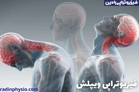 فیزیوتراپی آسیب شلاقی گردن یا ویپلش